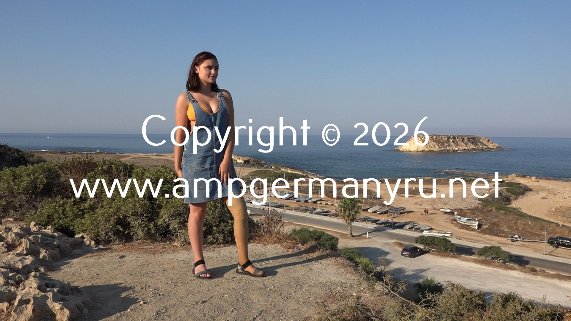 Johanna Walking with prostheses