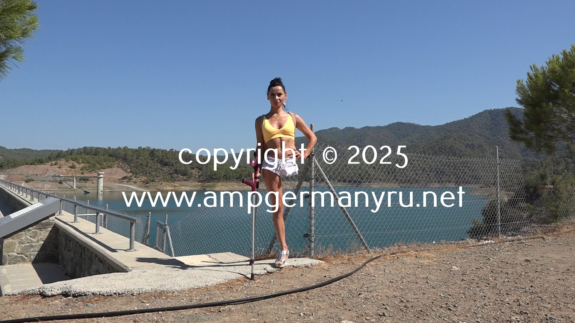 Julia Lake Trip with crutches